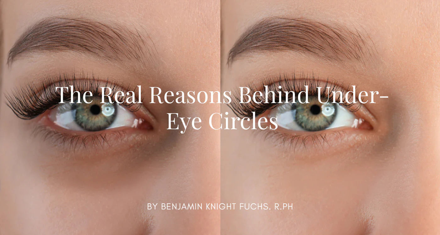 ¿POR QUÉ TIENES OJERAS—Y QUÉ PUEDES HACER AL RESPECTO?