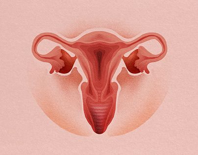 Síntomas del SOP y desequilibrio hormonal: Una guía para cada tipo de cuerpo - Parte I