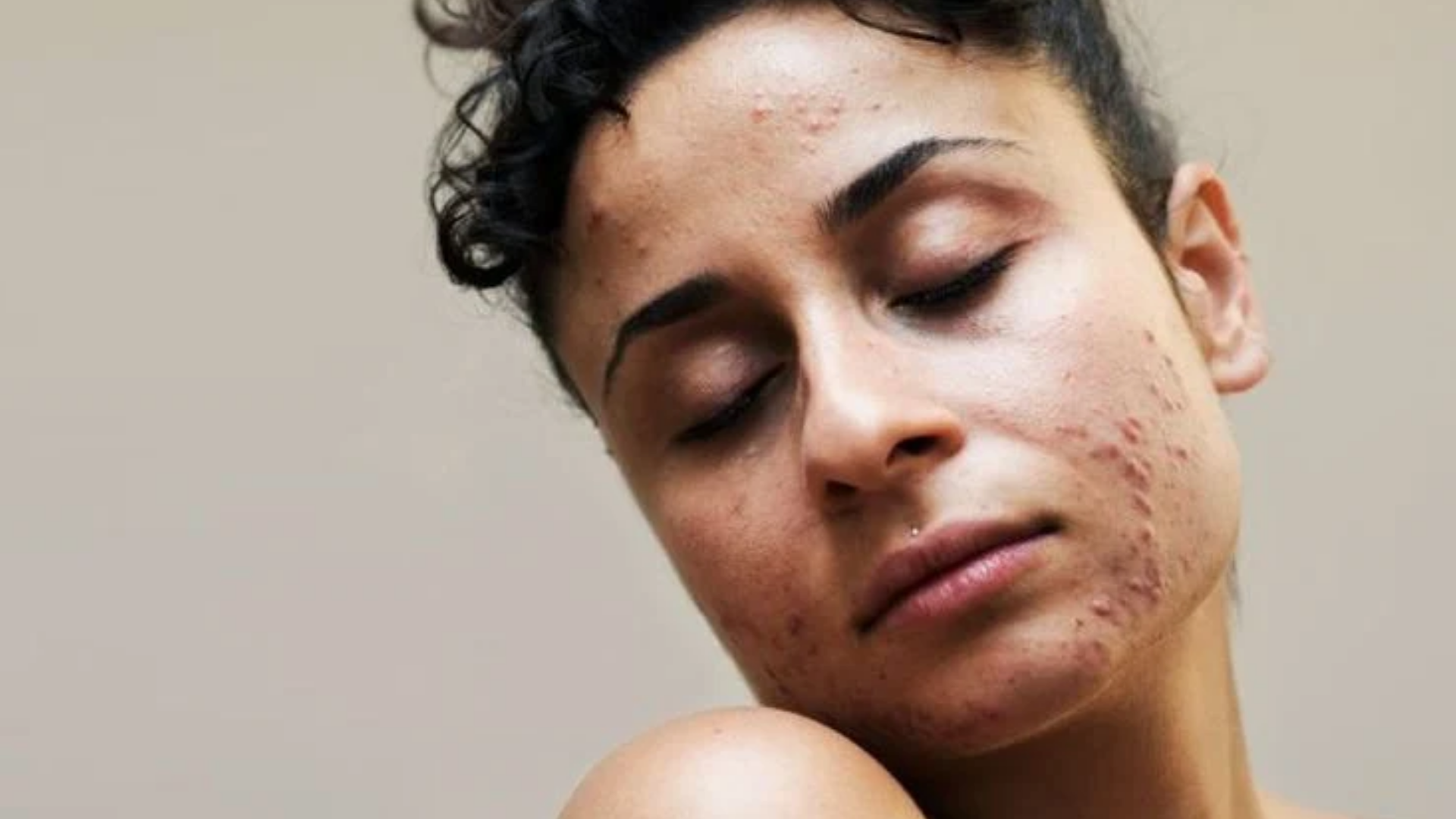 MÁS ALLÁ DE LA SUPERFICIE: CÓMO LA DIGESTIÓN, LAS HORMONAS Y EL ESTRÉS AFECTAN TU BRILLO